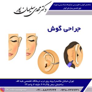 جراحی گوش - دکتر سلیمان پور
